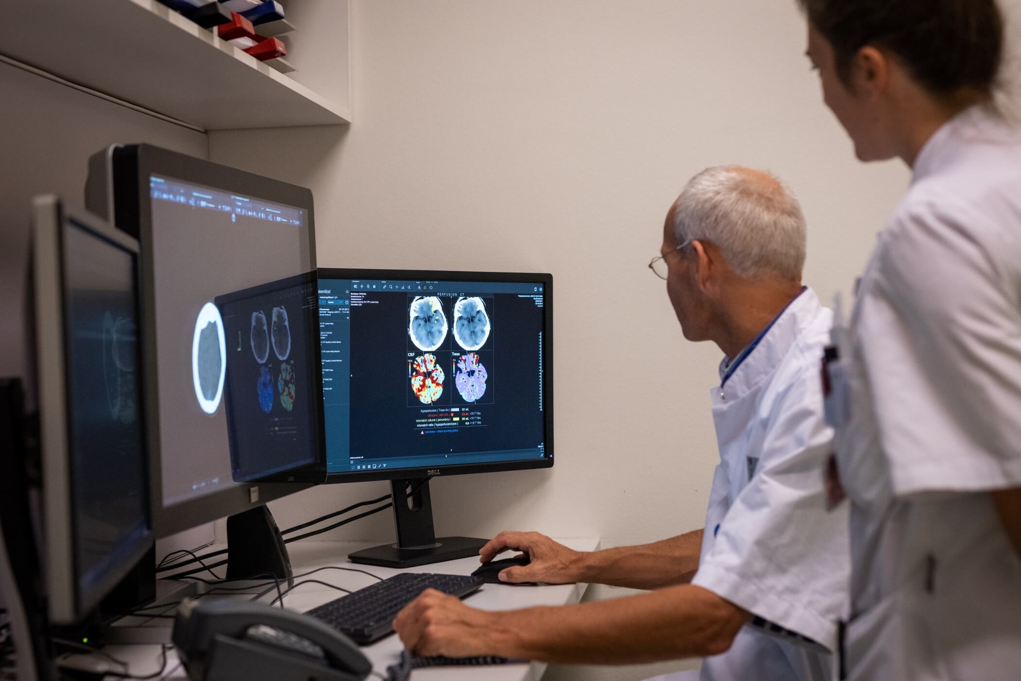 Doctor looking at impact of stroke on brain